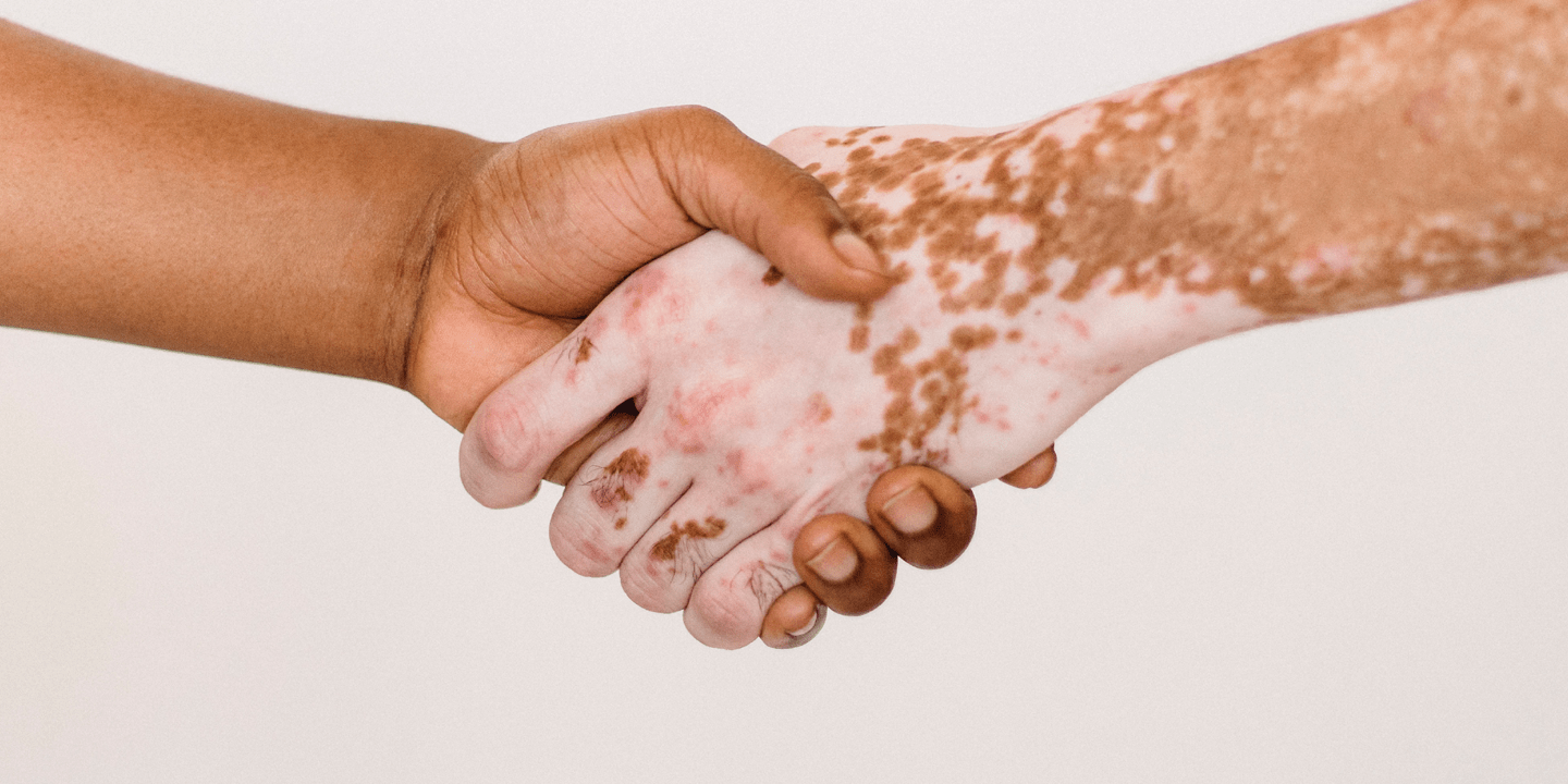 pexels-armin-rimoldi-530405